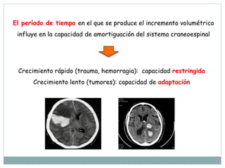 El período de tiempo en el que se produce el incremento volumétrico
influye en la capacidad de amortiguación del sistema craneoespinal
Crecimiento rápido (trauma, hemorragia): capacidad restringida
Crecimiento lento (tumores): capacidad de adaptación
 