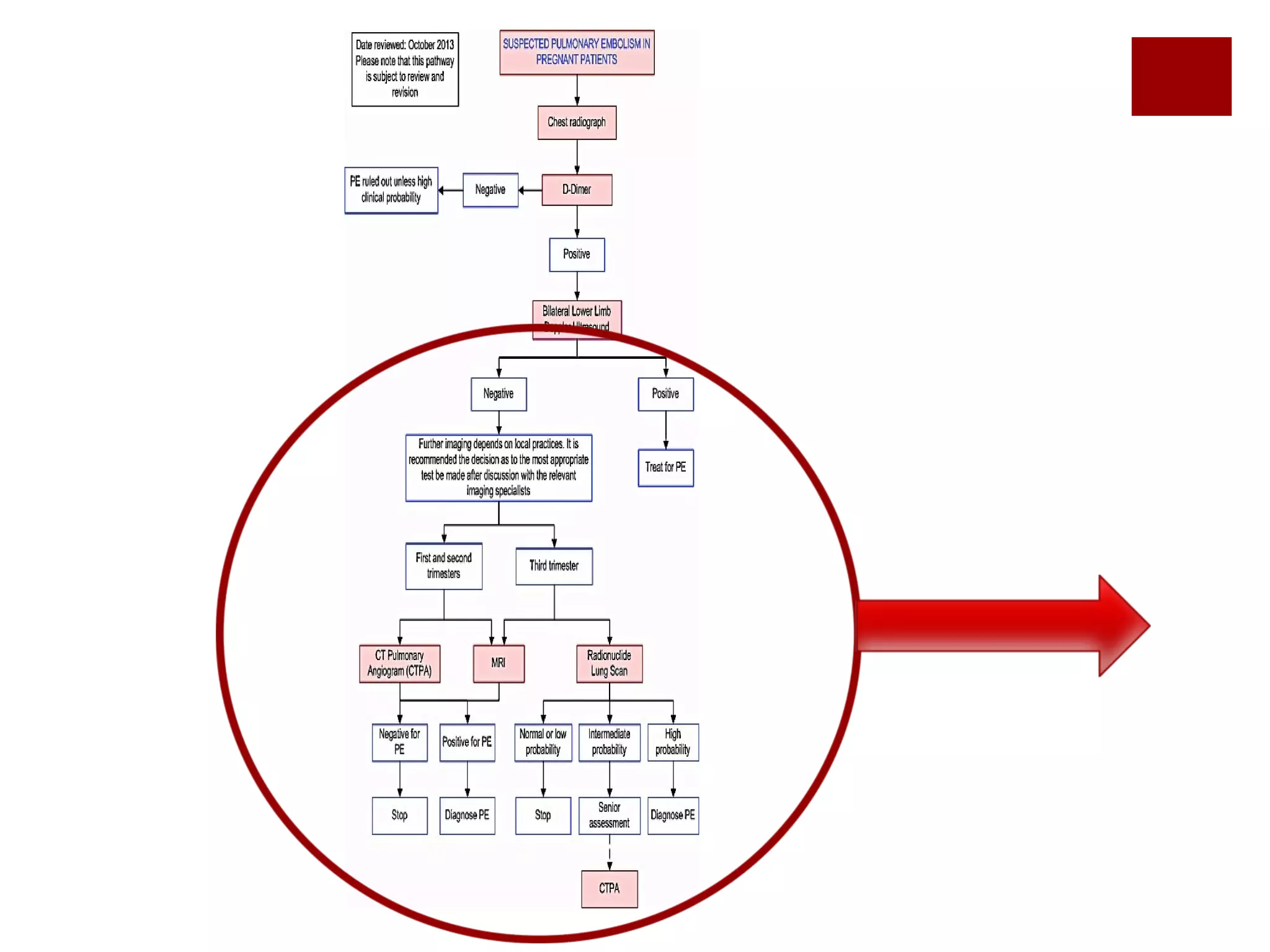 Investigation of suspected pulmonary embolism in pregnancy | PPT | Free