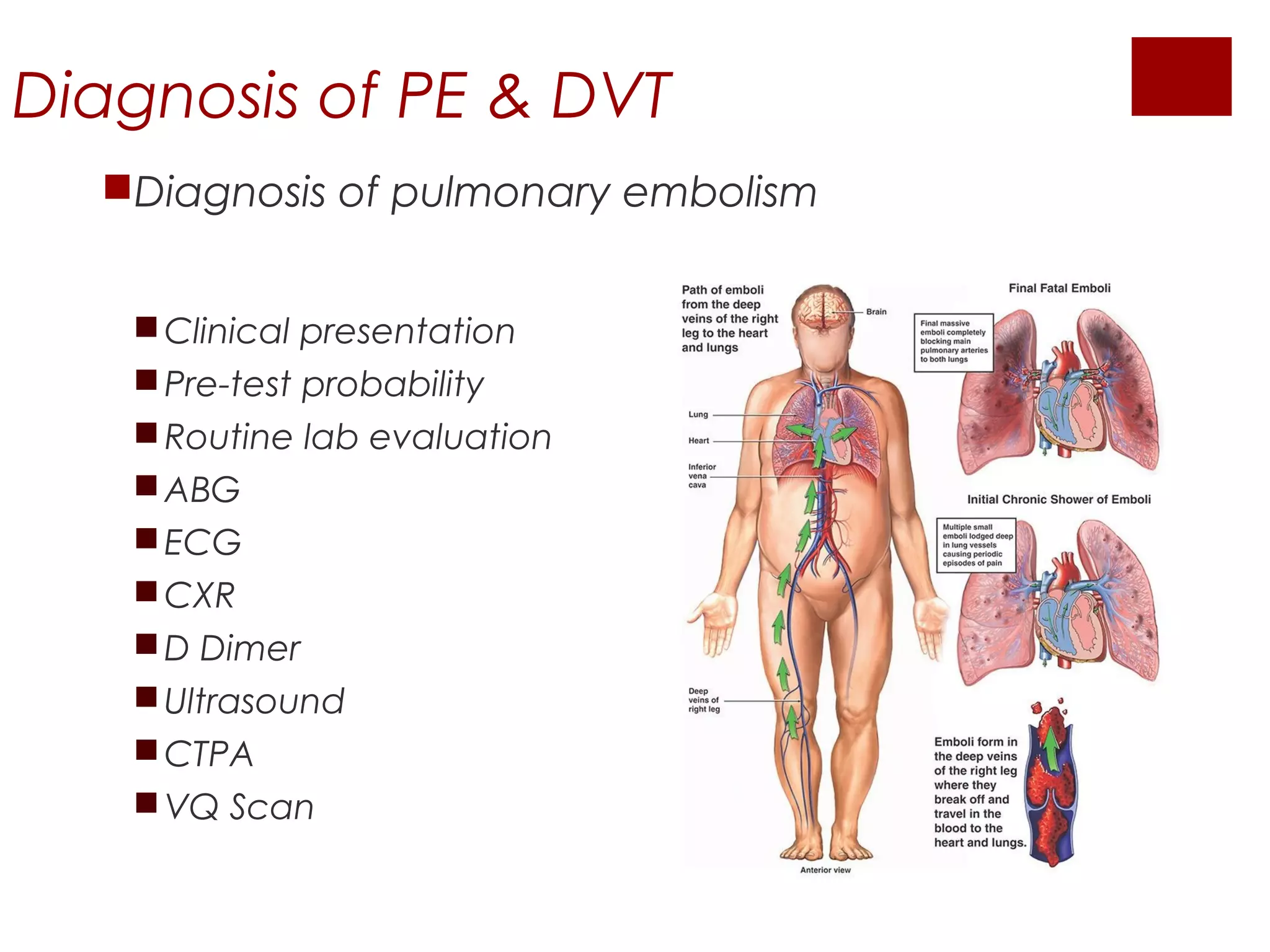Dvt Racgp Investigation of suspected pulmonary embolism in pregnancy | PPT