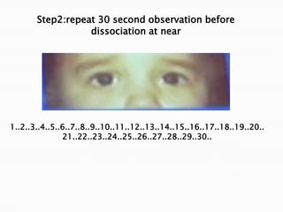 1..2..3..4..5..6..7..8..9..10..11..12..13..14..15..16..17..18..19..20..
21..22..23..24..25..26..27..28..29..30..
Step2:repeat 30 second observation before
dissociation at near
 