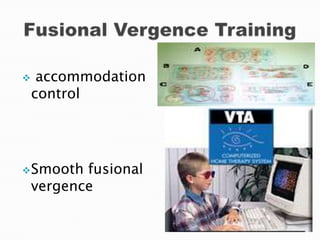  accommodation
control
Smooth fusional
vergence
 