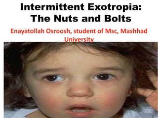 Intermittent Exotropia:
The Nuts and Bolts
Enayatollah Osroosh, student of Msc, Mashhad
University
 