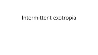Intermittent exotropia
 