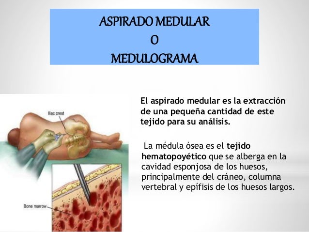 La osteocondrosis como la causa de la invalidez