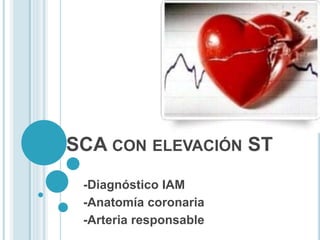 SCA CON ELEVACIÓN ST
-Diagnóstico IAM
-Anatomía coronaria
-Arteria responsable
 