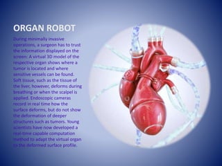 ORGAN ROBOT
During minimally invasive
operations, a surgeon has to trust
the information displayed on the
screen: A virtual 3D model of the
respective organ shows where a
tumor is located and where
sensitive vessels can be found.
Soft tissue, such as the tissue of
the liver, however, deforms during
breathing or when the scalpel is
applied. Endoscopic cameras
record in real time how the
surface deforms, but do not show
the deformation of deeper
structures such as tumors. Young
scientists have now developed a
real-time capable computation
method to adapt the virtual organ
to the deformed surface profile.
 