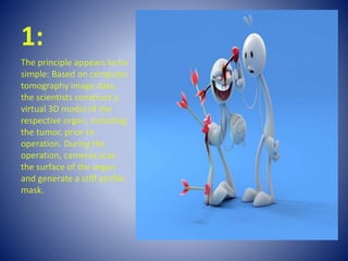 1:
The principle appears to be
simple: Based on computer
tomography image data,
the scientists construct a
virtual 3D model of the
respective organ, including
the tumor, prior to
operation. During the
operation, cameras scan
the surface of the organ
and generate a stiff profile
mask.
 