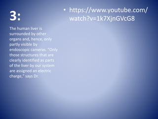 3:
• https://www.youtube.com/
watch?v=1k7XjnGVcG8
The human liver is
surrounded by other
organs and, hence, only
partly visible by
endoscopic cameras. "Only
those structures that are
clearly identified as parts
of the liver by our system
are assigned an electric
charge," says Dr.
 