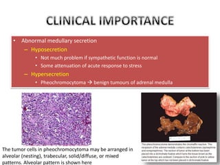 • Abnormal medullary secretion 
– Hyposecretion 
• Not much problem if sympathetic function is normal 
• Some attenuation of acute response to stress 
– Hypersecretion 
• Pheochromocytoma  benign tumours of adrenal medulla 
The tumor cells in pheochromocytoma may be arranged in 
alveolar (nesting), trabecular, solid/diffuse, or mixed 
patterns. Alveolar pattern is shown here 
 