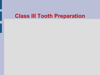 Class III Tooth Preparation 
 