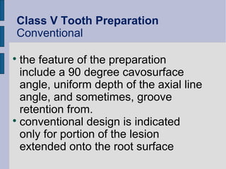 Class V Tooth Preparation 
Conventional 
 the feature of the preparation 
include a 90 degree cavosurface 
angle, uniform depth of the axial line 
angle, and sometimes, groove 
retention from. 
 conventional design is indicated 
only for portion of the lesion 
extended onto the root surface 
 