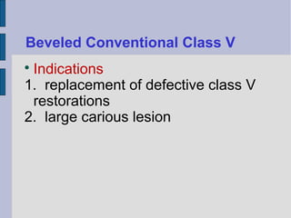Beveled Conventional Class V 
 Indications 
1. replacement of defective class V 
restorations 
2. large carious lesion 
 