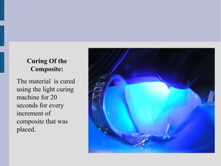 Curing Of the 
Composite: 
The material is cured 
using the light curing 
machine for 20 
seconds for every 
increment of 
composite that was 
placed. 
 