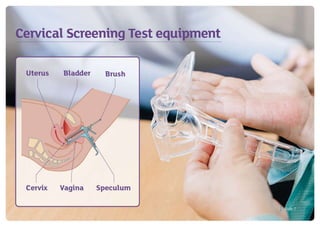 Cervical Check Animation Cervical screening – taking care of your health flipchart (English) | PPTX
