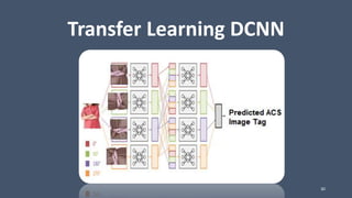 Transfer Learning DCNN
30
 