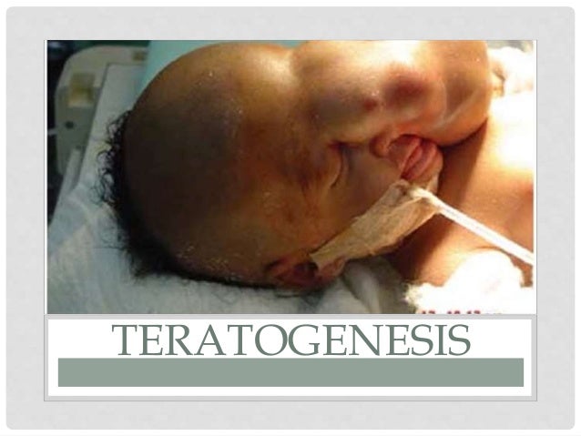Resultado de imagen para teratogenesis