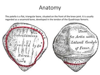 The patella is a flat, triangular bone, situated on the front of the knee-joint. It is usually
regarded as a sesamoid bone, developed in the tendon of the Quadriceps femoris.
Anatomy
 