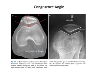 Congruence Angle
 