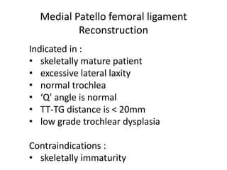 Indicated in :
• skeletally mature patient
• excessive lateral laxity
• normal trochlea
• ‘Q' angle is normal
• TT-TG distance is < 20mm
• low grade trochlear dysplasia
Contraindications :
• skeletally immaturity
Medial Patello femoral ligament
Reconstruction
 