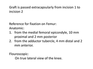 Graft is passed extracapsularly from incision 1 to
incision 2
Reference for fixation on Femur:
Anatomic:
1. from the medial femoral epicondyle, 10 mm
proximal and 2 mm posterior
2. from the adductor tubercle, 4 mm distal and 2
mm anterior.
Flouroscopic:
On true lateral view of the knee.
 