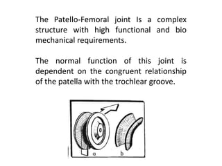 The Patello-Femoral joint Is a complex
structure with high functional and bio
mechanical requirements.
The normal function of this joint is
dependent on the congruent relationship
of the patella with the trochlear groove.
 