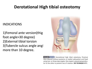 Derotational High tibial osteotomy
INDICATIONS
1)Femoral ante version(thigh
foot angle>30 degree)
2)External tibial torsion
3)Tubercle sulcus angle angle
more than 10 degree.
 