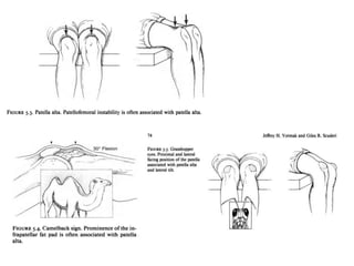 Patella dislocations | PPT