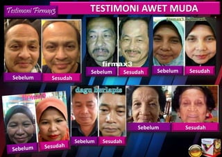 TESTIMONI AWET MUDATestimoni Firmax3
SesudahSebelum
SesudahSebelum SesudahSebelum
Sebelum Sesudah
Sebelum Sesudah
 