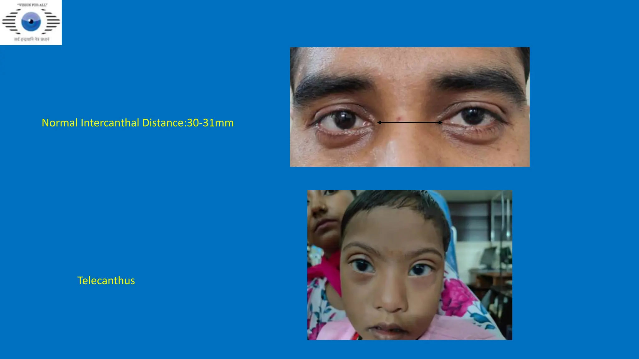 EYELID_ANATOMY presentation dhir bwn.pptx