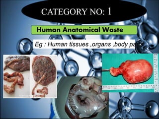 CATEGORY NO: 1
Human Anatomical Waste
Eg : Human tissues ,organs ,body parts
 