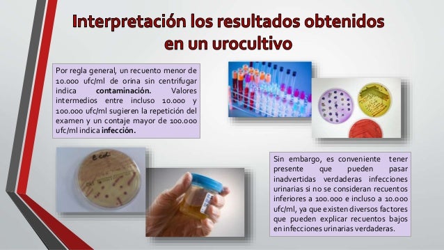 Como Explicar El Dolor De Regla A Un Hombre