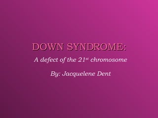 DOWN SYNDROME: A defect of the 21 st  chromosome By: Jacquelene Dent 