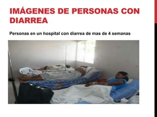 IMÁGENES DE PERSONAS CON 
DIARREA 
Personas en un hospital con diarrea de mas de 4 semanas 
