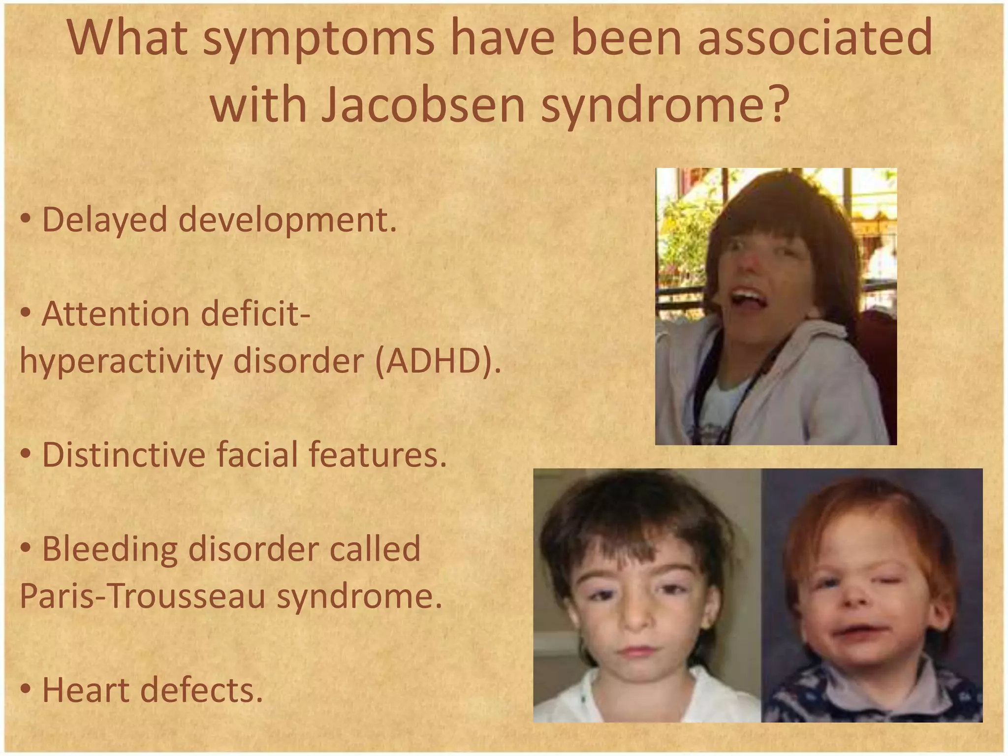 Unveiling The Truth: Famous Faces Battling Jacobsen Syndrome - rjl6if7