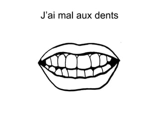 J’ai mal aux dents 