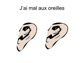 J’ai mal aux oreilles 
