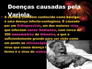 Doenças causadas pela Variola. A  varíola  (também conhecida como  bexiga ) é uma doença infecto-contagiosa. É causada por um  Orthopoxvirus , um dos maiores  vírus  que infectam  seres humanos , com cerca de 300  nanometros  de  diâmetro , o que é suficientemente grande para ser visto como um ponto ao  microscópio óptico  (o único vírus que causa doença também visível desta forma é o vírus do  molusco contagioso ).  