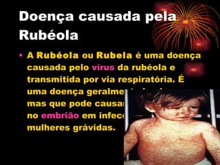 Doença causada pela Rubéola A  Rubéola  ou  Rubela  é uma doença causada pelo  vírus  da rubéola e transmitida por via respiratória. É uma doença geralmente benigna, mas que pode causar malformações no  embrião  em infecções de mulheres grávidas. 