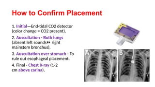 RESPIRATORY TREATMENTS for a human.pptx