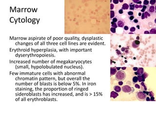 MarrowCytologyMarrow aspirate of poor quality, dysplastic changes of all three cell lines are evident. Erythroid hyperplasia, with important dyserythropoiesis. Increased number of megakaryocytes (small, hypolobulated nucleus). Few immature cells with abnormal chromatin pattern, but overall the number of blasts is below 5%. In iron staining, the proportion of ringed sideroblasts has increased, and is > 15% of all erythroblasts. 