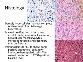 HistologyDensely hypercellular marrow, complete replacement of fat, trilineage hyperplasia. Marked proliferation of immature myeloid cells,  abnormal localization, hypolobularmegakaryocytes, increased reticulin and secondary marrow fibrosis. Immunostains for CD34 shows some positive endothelial cells, few immature hemopoietic cells. The overall proportion of CD34-positive blasts is <5%. 