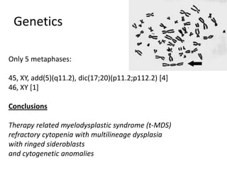GeneticsOnly 5 metaphases: 45, XY, add(5)(q11.2), dic(17;20)(p11.2;p112.2) [4]46, XY [1]Conclusions Therapy related myelodysplastic syndrome (t-MDS)refractory cytopenia with multilineage dysplasiawith ringed sideroblastsand cytogenetic anomalies