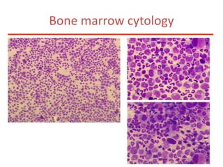 Bone marrow cytology