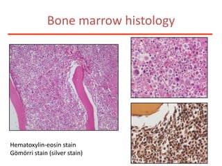 Bone marrow histologyHematoxylin-eosin stainGömörri stain (silver stain)