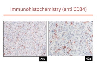 Immunohistochemistry (anti CD34)40x20x