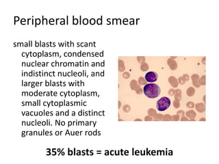 Peripheral blood smearsmallblastswithscantcytoplasm, condensednuclearchromatinandindistinctnucleoli, andlarger blastswithmoderate cytoplasm, smallcytoplasmicvacuolesand a distinctnucleoli. Noprimarygranulesor Auer rods35% blasts = acuteleukemia
