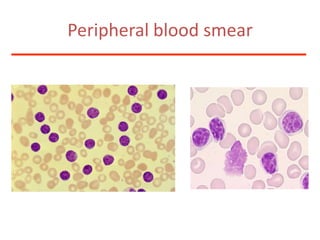 How would you treat this patient?