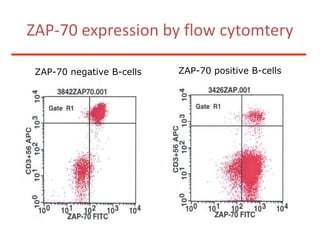 What will be the treatment strategy?Watch and waitRegular follow-up (every 6 months)Constitutional symptomsOrganomegalyPeripheral blood countWhy is it acceptable to restrict diagnostics to a minimal program?elderly patient no intention of curative therapyasymptomatic patient no treatment required