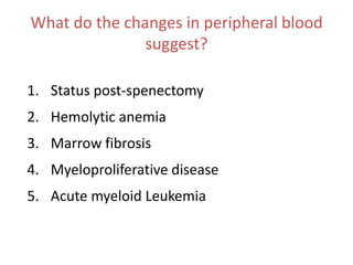 Clinical prognostic factors in CLLSymptomatic CLL; B-symptomsFever, night sweat, weight lossDisease stageRai or BinetLymphocyte count> 50 x109/LDoubling time of absolute lymphocyte count< 12 months