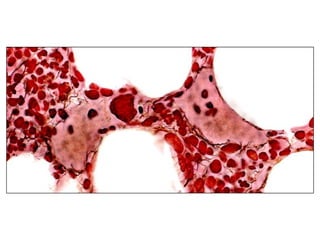 ZAP-70 expression by flow cytomteryZAP-70 positive B-cellsZAP-70 negative B-cells